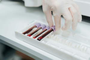 Study finds multiple PFAS, the man-made ‘forever chemicals’, in 98.5% of people tested in US study